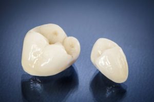 Dental Crowns Crawford Leishman Dental Vineyard Utah Dentist