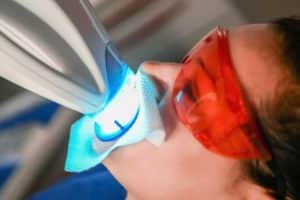 Teeth Whitening Cosmetic-Dentistry-Teeth-Whitening Crawford Leishman Dental dentist in Vineyard Utah Dr. Chris Crawford Dr. Rick Leishman Dr. Matt Fletcher