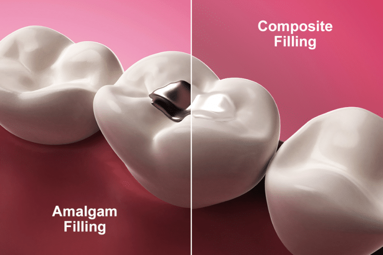 dental fillings Dr. Chris Crawford Dr. Rick Leishman Dr. Matt Fletcher Crawford Leishman Dental General, Cosmetic, Restorative, Preventative Dentistry Dentist in Vineyard, UT 84059